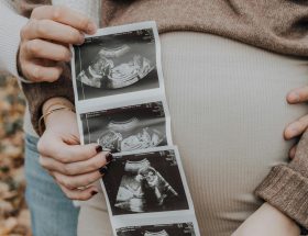 Baby bump photograph